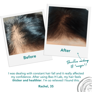 Bao H. Lab - Bao H. Lab Hair Loss Ampoule (Roll - On) - Stellar K - Beauty